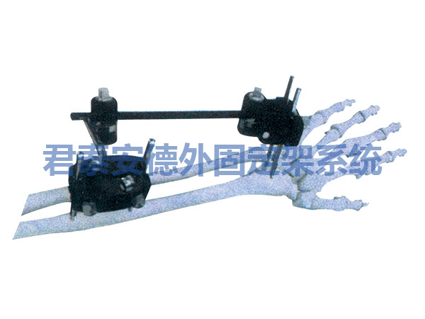 桡骨关节外固定支架