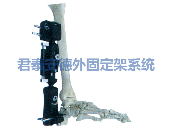 胫骨远端骨折外固定支架